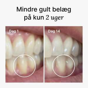 D2 Pro Elektrisk Tandbørste Dentis